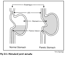 can gastroparesis give you diarrhea